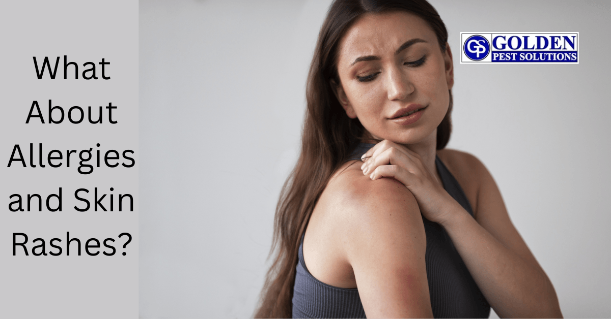 What About Allergies and Skin Rashes